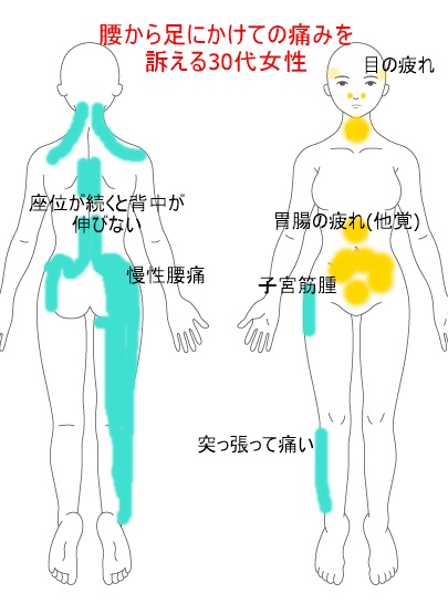 しびれ ヘルニア 神戸で鍼灸なら対話を大切にするミントはり灸院