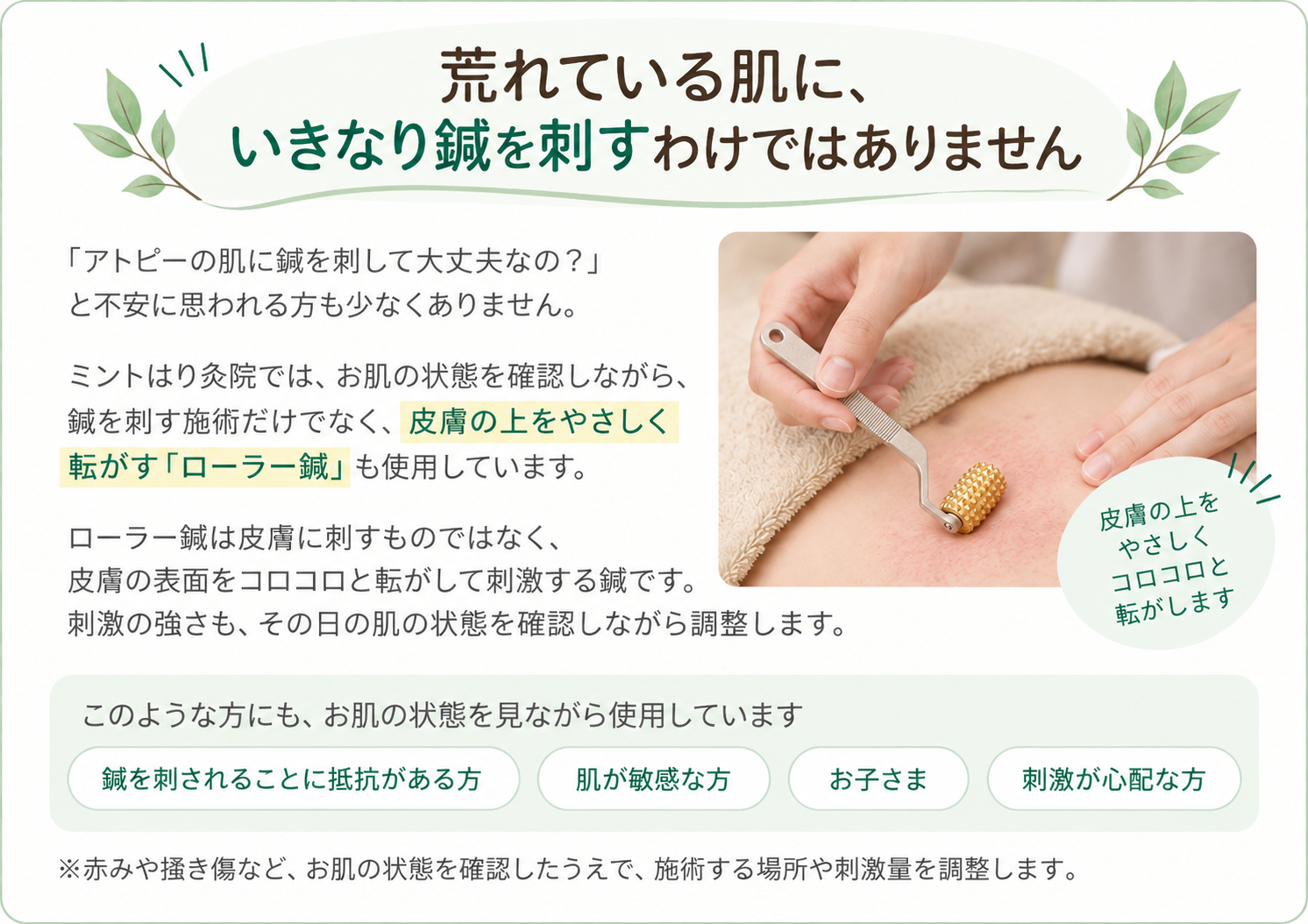 荒れている肌に、いきなり鍼を刺すわけではありません。ローラー鍼についての説明