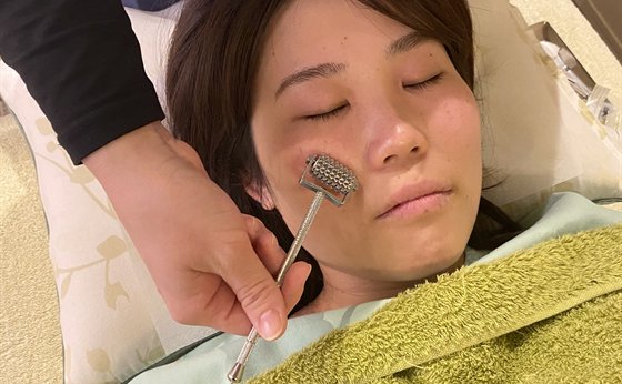 鍼の細さを説明する様子