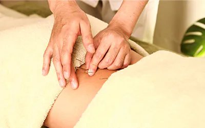 鍼灸施術中の手元